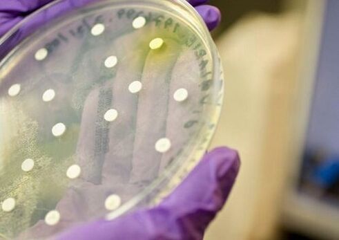 Bacterial culture for diagnosing prostatitis