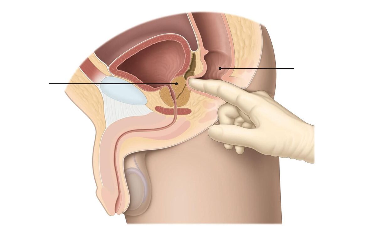 Prostate massage technique